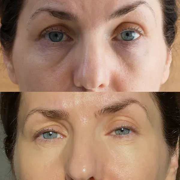 Antes e depois — Diana K.