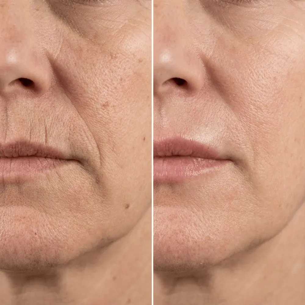 Antes e depois — Aitana V.