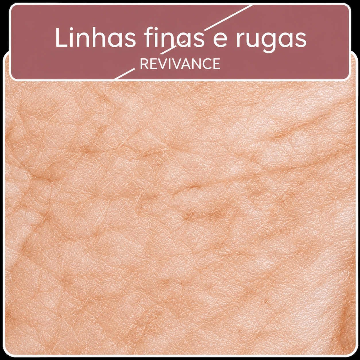 Linhas finas e rugas — Revivance