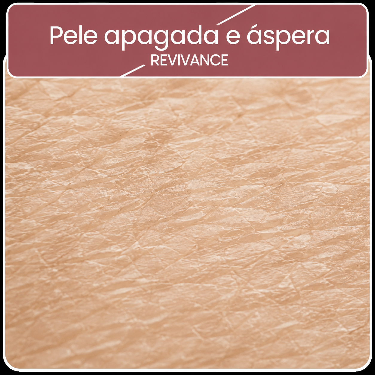 Pele apagada e áspera — Revivance