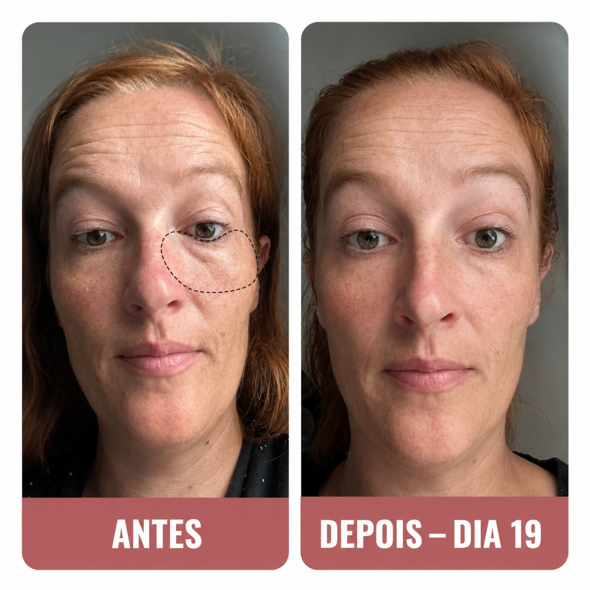 Paula N. — avant et après contour des yeux en 19 jours