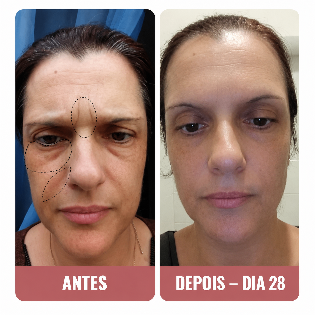 Helena P. — avant et après contour des yeux en 28 jours