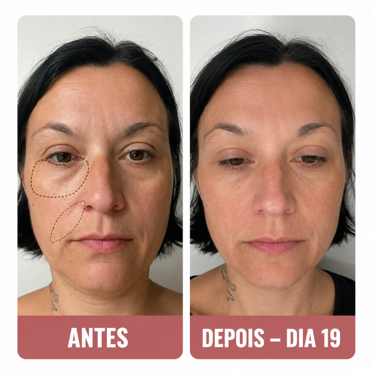 Carmen J. — avant et après contour des yeux en 19 jours