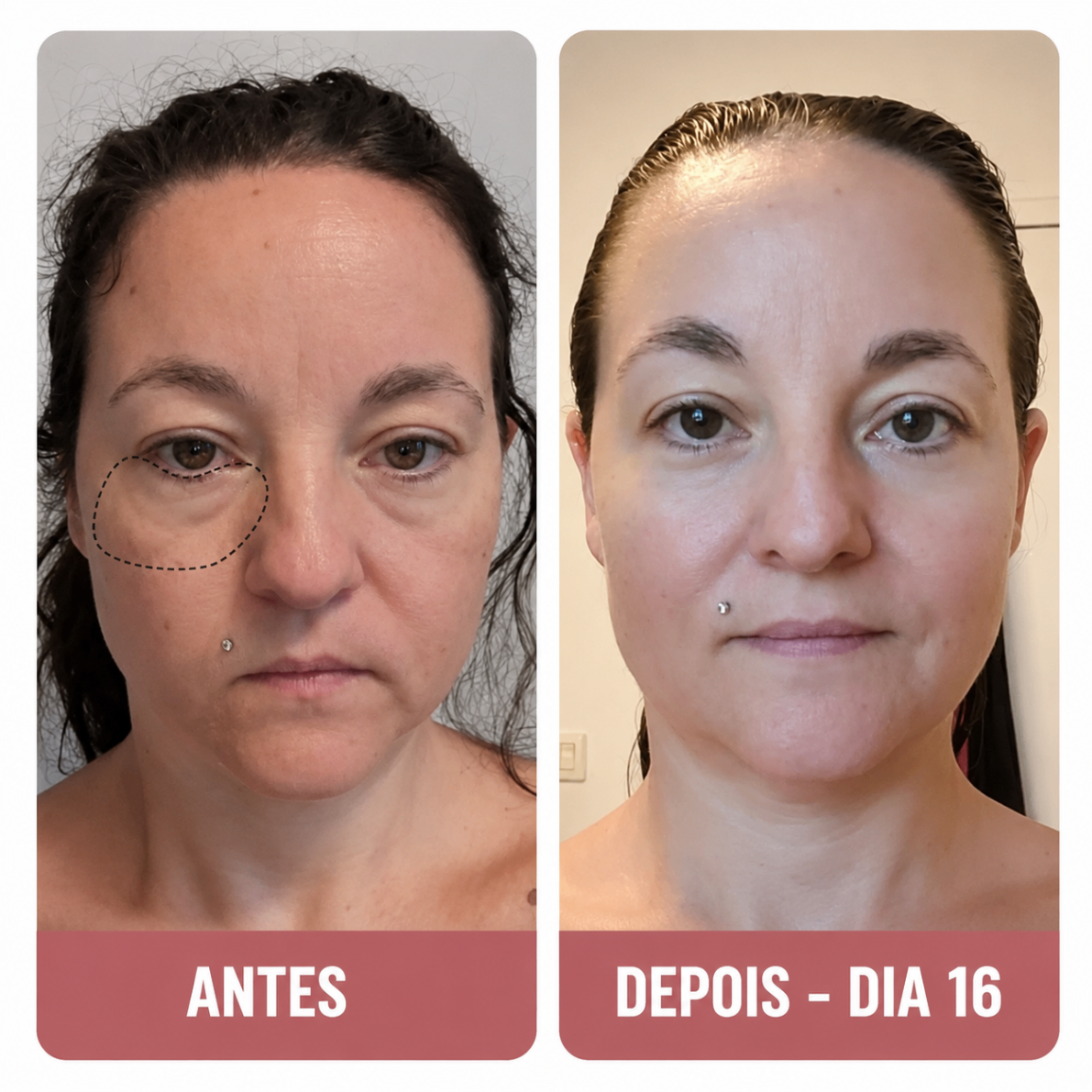 Maria G. — avant et après contour des yeux en 16 jours