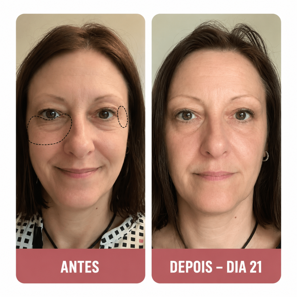 Ana T. — avant et après contour des yeux en 21 jours