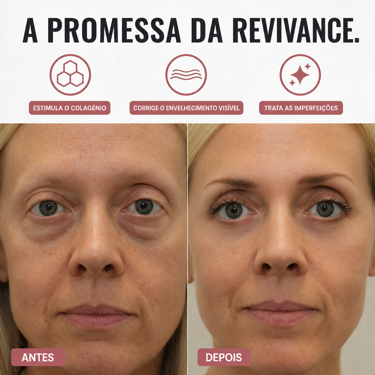A promessa da Revivance — antes e depois do contorno dos olhos
